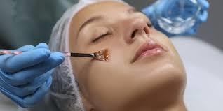 Glycolic Peel